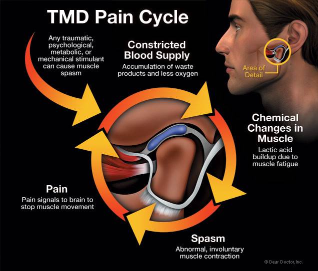 Successfully Treated TMJ And Facial Pain With Lasers Boynton Beach